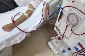 IMPACT OF END-STAGE RENAL FAILURE ON QUALITY OF SLEEP IN HAEMODIALYSIS RECIPIENTS AT SOHAG  UNIVERSITY HOSPITAL